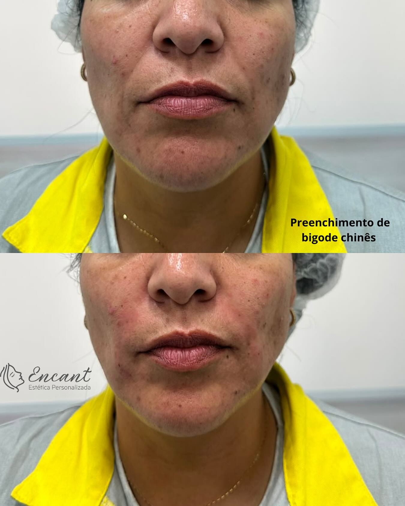 Preenchimento de bigode chinês